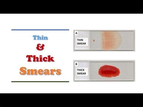 how is blood thickness measured|why is my blood gooey.